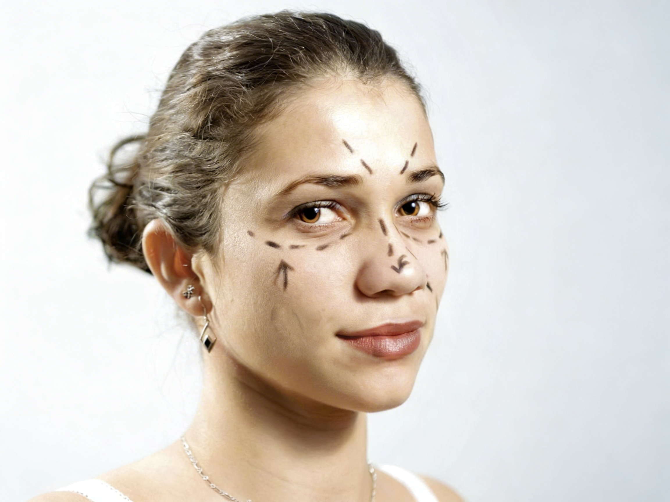 纽约面部整形手术 - 拉皮眼睑鼻整形